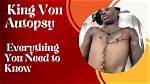 Unveiling the Mystery: King Von Autopsy Pic and Its Impact